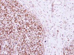 Invitrogen TFAM Polyclonal Antibody 100 &mu;L; Unconjugated:Antibodies,