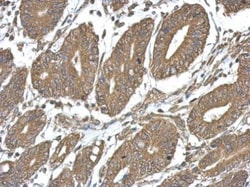 Invitrogen TICAM2 Polyclonal Antibody 100 &mu;L; Unconjugated:Antibodies,