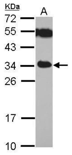 Invitrogen TICAM2 Polyclonal Antibody 100 &mu;L; Unconjugated:Antibodies,