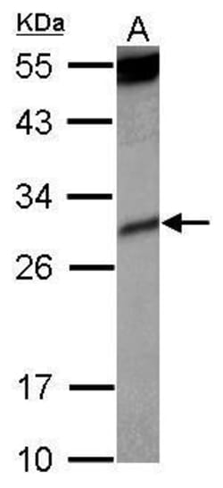 Invitrogen KIR2DS4 Polyclonal Antibody 100 μL; Unconjugated:Antibodies,