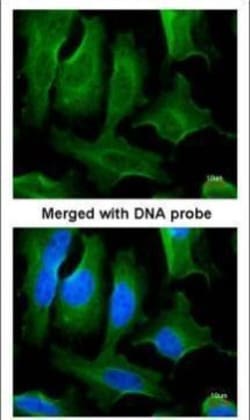 Invitrogen&trade;&nbsp;Fibronectin Polyclonal Antibody