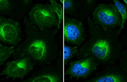Invitrogen beta-2 Microglobulin Polyclonal Antibody 100 &mu;L; Unconjugated:Antibodies,