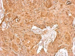 Invitrogen beta-2 Microglobulin Polyclonal Antibody 100 &mu;L; Unconjugated:Antibodies,