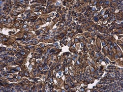 Invitrogen beta-2 Microglobulin Polyclonal Antibody 100 &mu;L; Unconjugated:Antibodies,