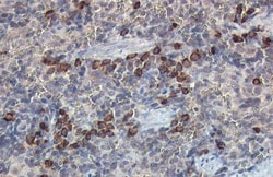 Invitrogen beta-2 Microglobulin Polyclonal Antibody 100 &mu;L; Unconjugated:Antibodies,