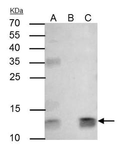 Invitrogen beta-2 Microglobulin Polyclonal Antibody 100 &mu;L; Unconjugated:Antibodies,