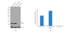 Invitrogen beta-2 Microglobulin Polyclonal Antibody 100 &mu;L; Unconjugated:Antibodies,