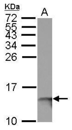 Invitrogen beta-2 Microglobulin Polyclonal Antibody 100 &mu;L; Unconjugated:Antibodies,