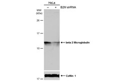 Invitrogen beta-2 Microglobulin Polyclonal Antibody 100 &mu;L; Unconjugated:Antibodies,