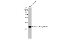 Invitrogen beta-2 Microglobulin Polyclonal Antibody 100 &mu;L; Unconjugated:Antibodies,