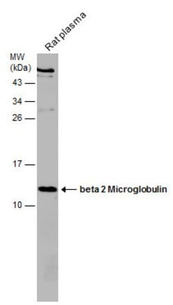 Invitrogen beta-2 Microglobulin Polyclonal Antibody 100 &mu;L; Unconjugated:Antibodies,