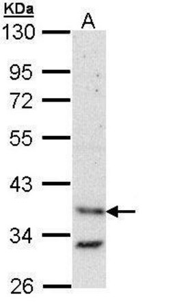 Invitrogen BAG1 Polyclonal Antibody 100 &mu;L | Buy Online | Invitrogen&trade; | Fisher Scientific
