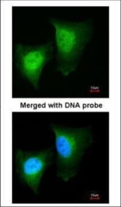 Invitrogen DAXX Polyclonal Antibody 100 &mu;L; Unconjugated:Antibodies,