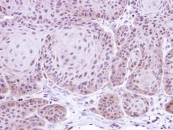 Invitrogen DAXX Polyclonal Antibody 100 &mu;L; Unconjugated:Antibodies,