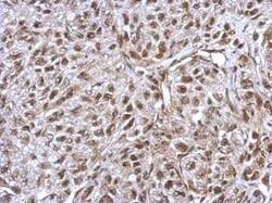 Invitrogen FLI1 Polyclonal Antibody 100 &mu;L; Unconjugated:Antibodies,