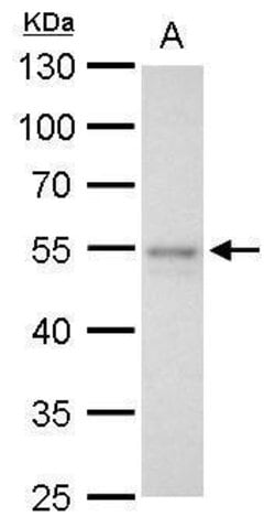 Invitrogen FLI1 Polyclonal Antibody 100 &mu;L; Unconjugated:Antibodies,