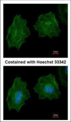 Invitrogen Filamin A alpha-2 Polyclonal Antibody 100 &mu;L; Unconjugated:Antibodies,
