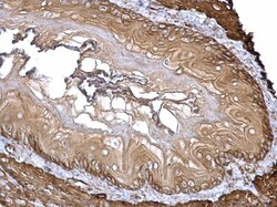 Invitrogen Filamin A alpha-2 Polyclonal Antibody 100 &mu;L; Unconjugated:Antibodies,