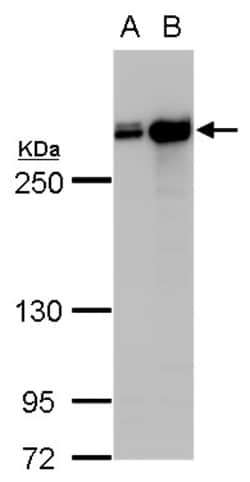 Invitrogen Filamin A alpha-2 Polyclonal Antibody 100 &mu;L; Unconjugated:Antibodies,