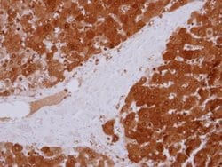 Invitrogen GPT Polyclonal Antibody 100 &mu;L; Unconjugated:Antibodies,