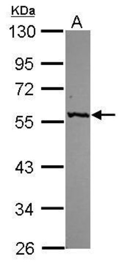 Invitrogen GPT Polyclonal Antibody 100 &mu;L; Unconjugated:Antibodies,