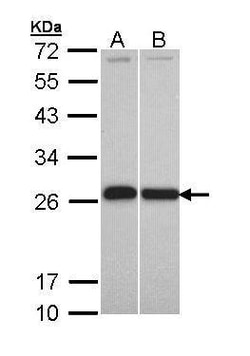 Invitrogen GSTP1 Polyclonal Antibody 100 &mu;L | Buy Online | Invitrogen&trade; | Fisher Scientific