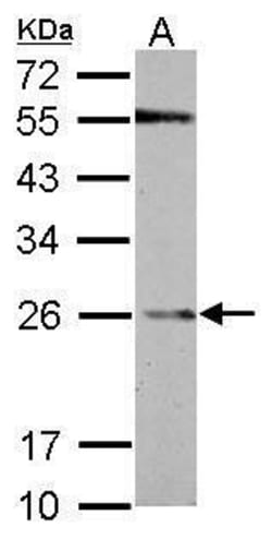 Invitrogen GSTP1 Polyclonal Antibody 100 &mu;L | Buy Online | Invitrogen&trade; | Fisher Scientific