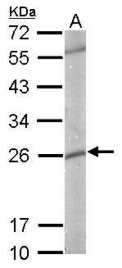 Invitrogen GSTP1 Polyclonal Antibody 100 &mu;L | Buy Online | Invitrogen&trade; | Fisher Scientific