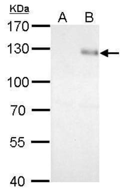 Invitrogen ITGB1 Polyclonal Antibody 100 &mu;L; Unconjugated:Antibodies,