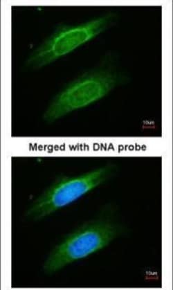 Invitrogen Cytokeratin 8 Polyclonal Antibody 100 &mu;L | Buy Online | Invitrogen&trade; | Fisher Scientific