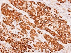 Invitrogen Cytokeratin 8 Polyclonal Antibody 100 &mu;L; Unconjugated:Antibodies,