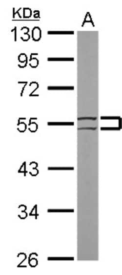 Invitrogen Cytokeratin 8 Polyclonal Antibody 100 &mu;L; Unconjugated:Antibodies,
