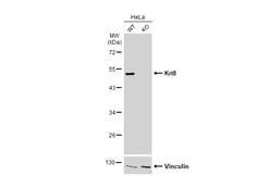 Invitrogen Cytokeratin 8 Polyclonal Antibody 100 &mu;L | Buy Online | Invitrogen&trade; | Fisher Scientific