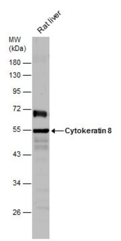 Invitrogen Cytokeratin 8 Polyclonal Antibody 100 &mu;L; Unconjugated:Antibodies,