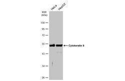 Invitrogen Cytokeratin 8 Polyclonal Antibody 100 &mu;L; Unconjugated:Antibodies,