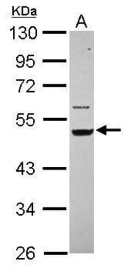 Invitrogen Cytokeratin 14 Polyclonal Antibody 100 &mu;L; Unconjugated:Antibodies,