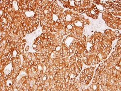 Invitrogen Cytokeratin 18 Polyclonal Antibody 100 &mu;L; Unconjugated:Antibodies,