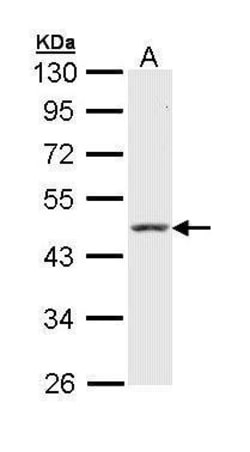 Invitrogen Cytokeratin 18 Polyclonal Antibody 100 &mu;L; Unconjugated:Antibodies,