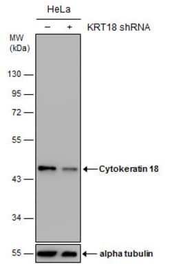 Invitrogen Cytokeratin 18 Polyclonal Antibody 100 &mu;L; Unconjugated:Antibodies,