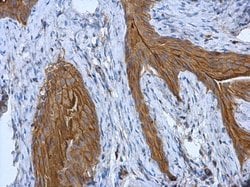 Invitrogen Cytokeratin 18 Polyclonal Antibody 100 &mu;L; Unconjugated:Antibodies,