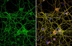 Invitrogen Tau Polyclonal Antibody 100 &mu;L; Unconjugated:Anticorps, Polyclonal