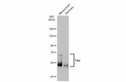 Invitrogen Tau Polyclonal Antibody 100 &mu;L; Unconjugated:Anticorps, Polyclonal