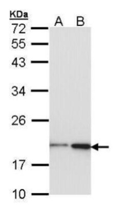 Invitrogen NME1 Polyclonal Antibody 100 μL; Unconjugated:Antibodies,