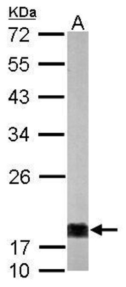 Invitrogen NME1 Polyclonal Antibody 100 μL; Unconjugated:Antibodies,