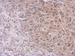 Invitrogen PI3K p85 alpha Polyclonal Antibody 100 &mu;L; Unconjugated:Antibodies,