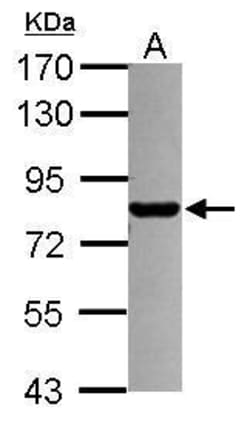 Invitrogen PML Polyclonal Antibody 100 &mu;L; Unconjugated:Antibodies,