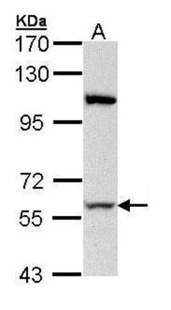 RPA70 Polyclonal Antibody, Invitrogen 100 &mu;L; Unconjugated:Antibodies,