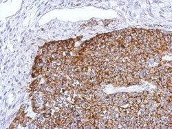 Invitrogen TRAF6 Polyclonal Antibody 100 &mu;L; Unconjugated:Antibodies,
