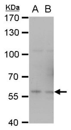 Invitrogen TRAF6 Polyclonal Antibody 100 &mu;L; Unconjugated:Antibodies,