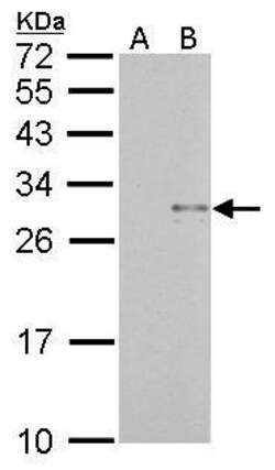 Invitrogen TRAIL Polyclonal Antibody 100 μL; Unconjugated:Antibodies,